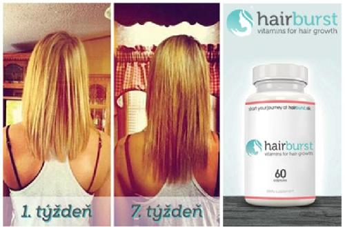 Přírodní produkt na podporu růstu vlasů Hairburst